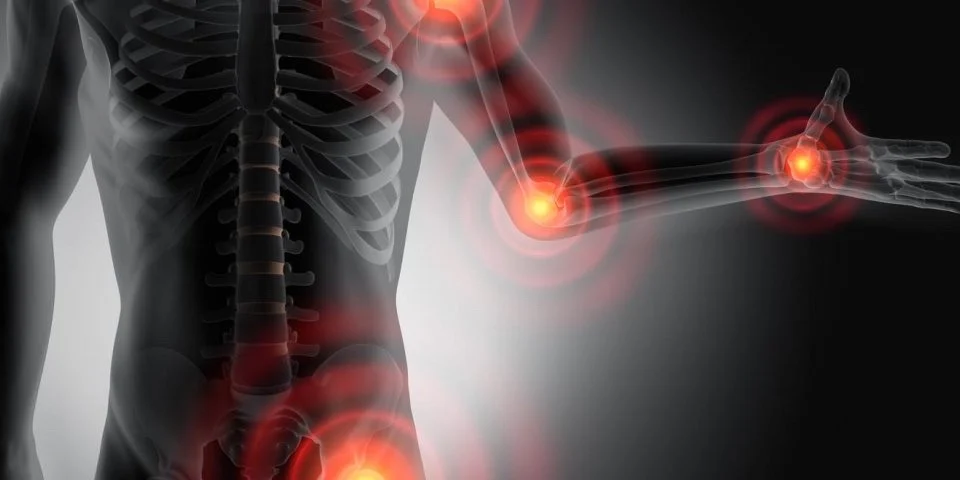 Il dolore sordo della fibromialgia