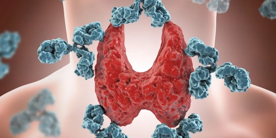 Le domande piu ricorrenti sul nodulo alla tiroide